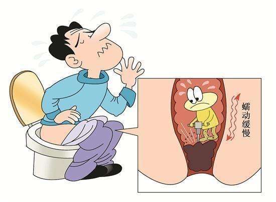 内痔如何诊断？